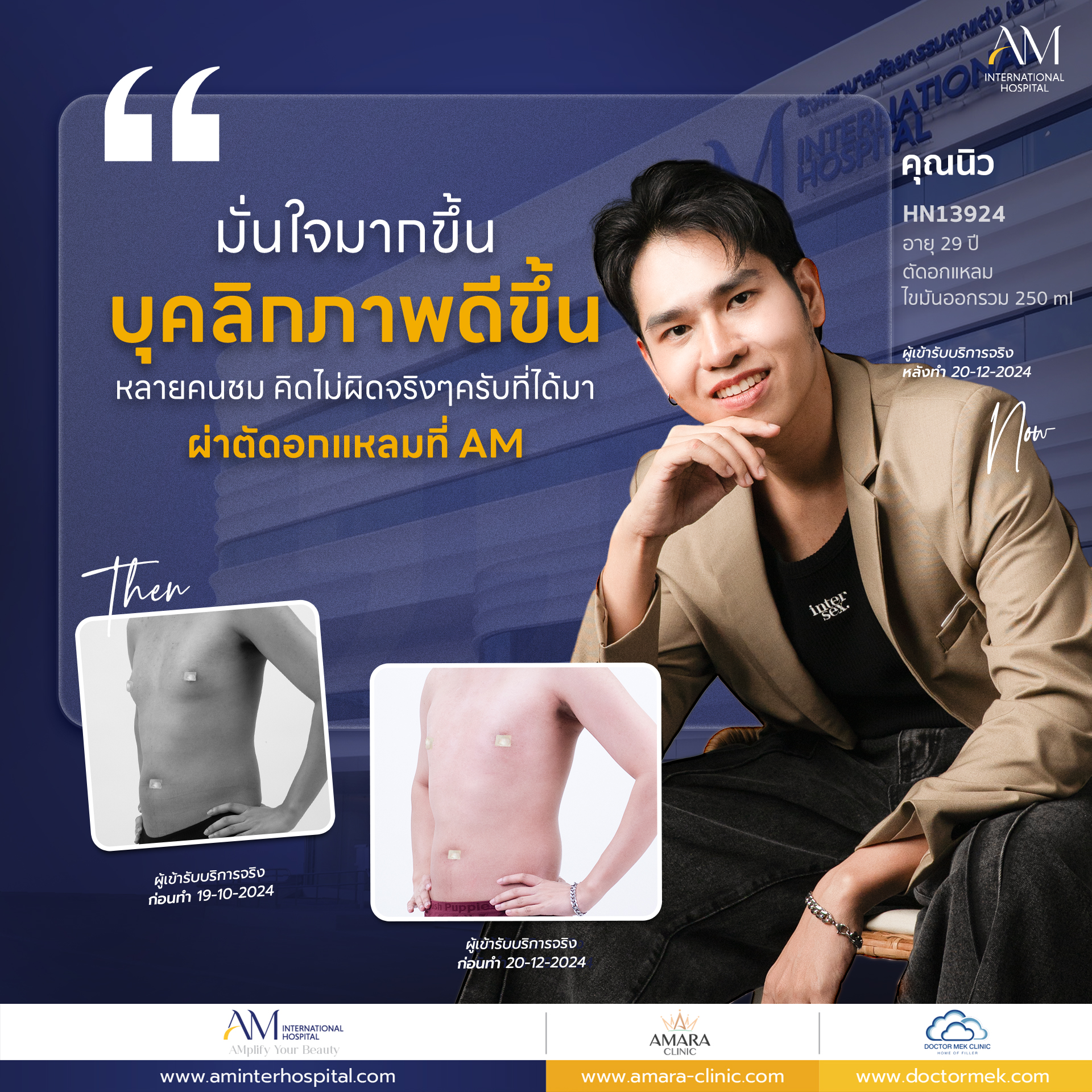 Review+Quote K.นิว 13924 ปิดหัวนม