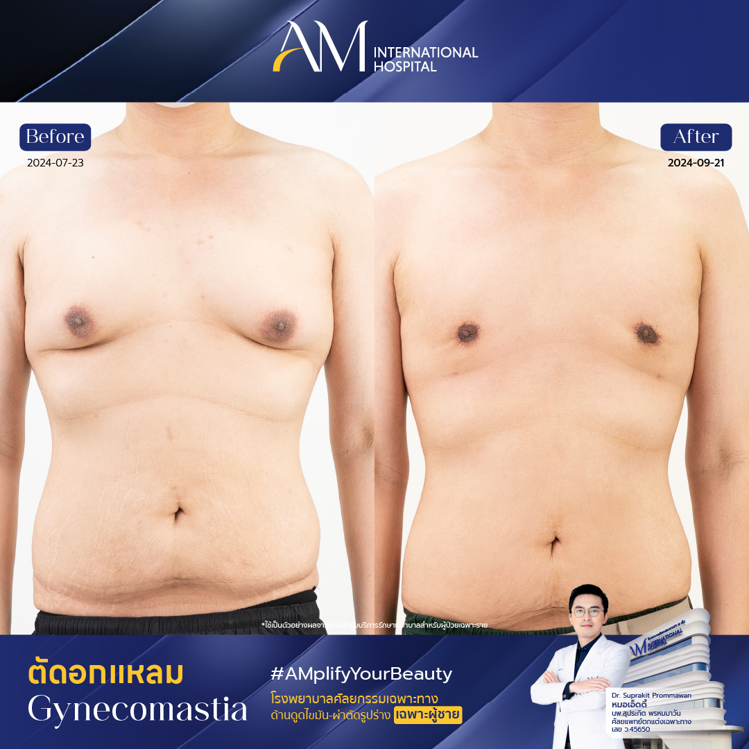 13656 - พีช-01