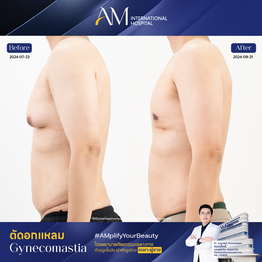 13656 - พีช-03