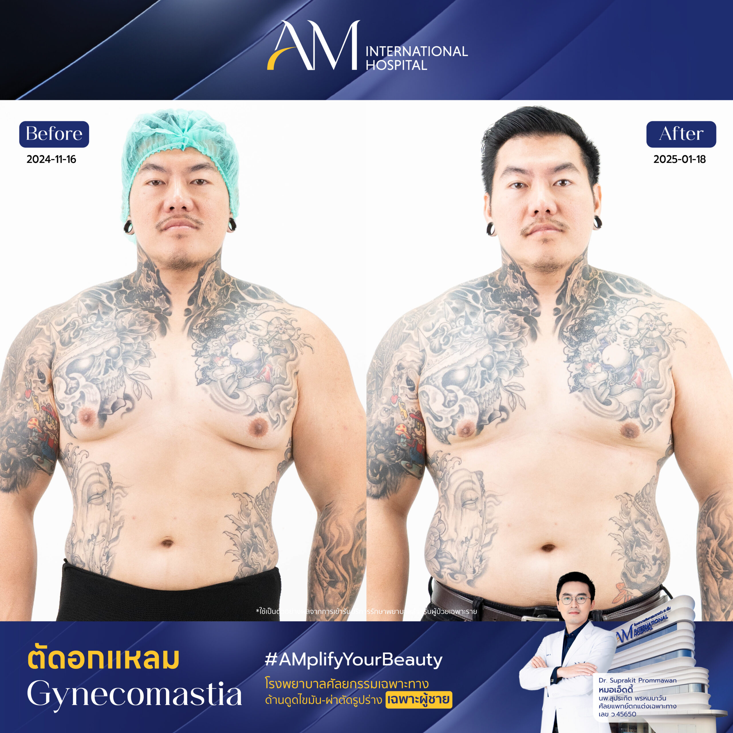 15211 ดรีม ตัดหน้าอก-01