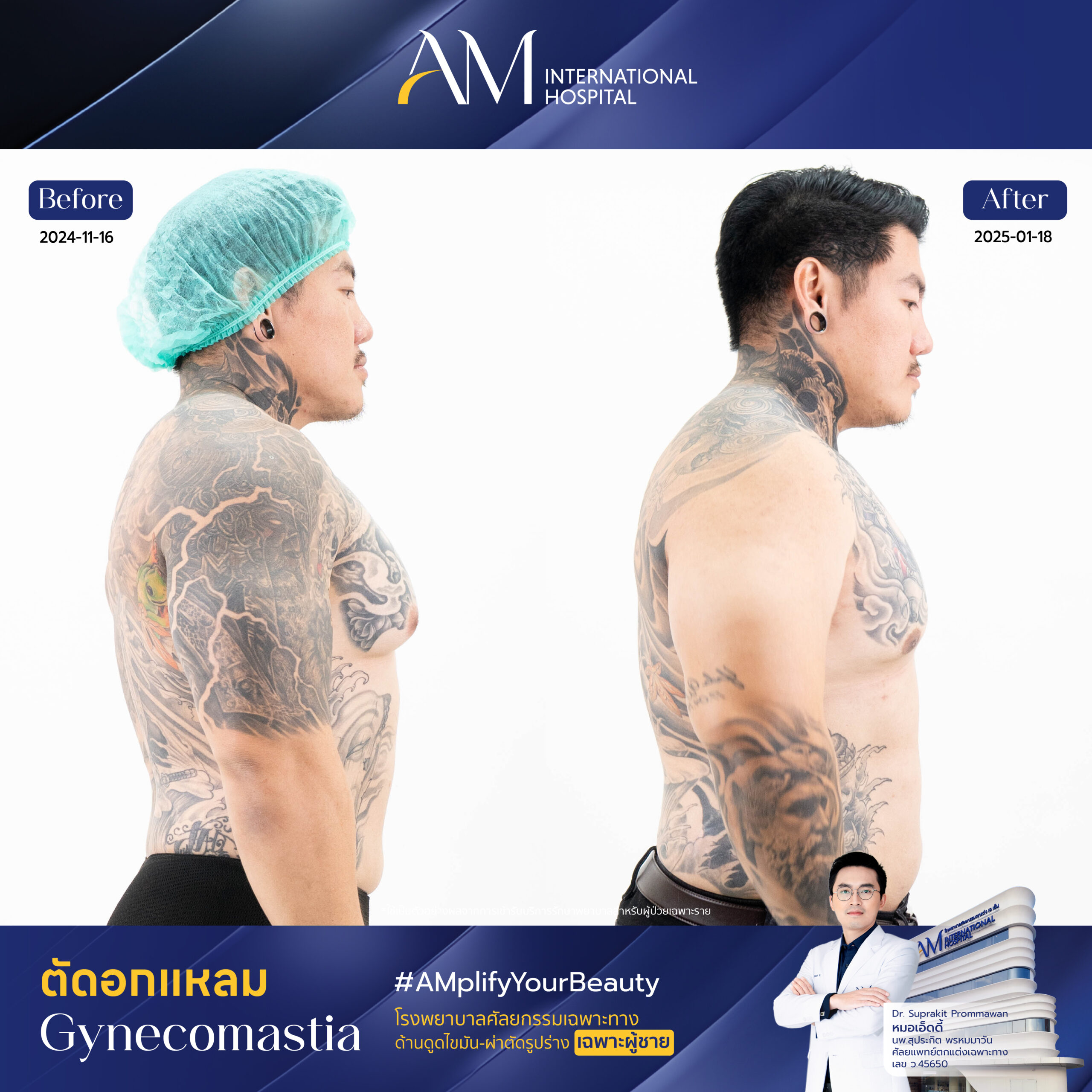 15211 ดรีม ตัดหน้าอก-03