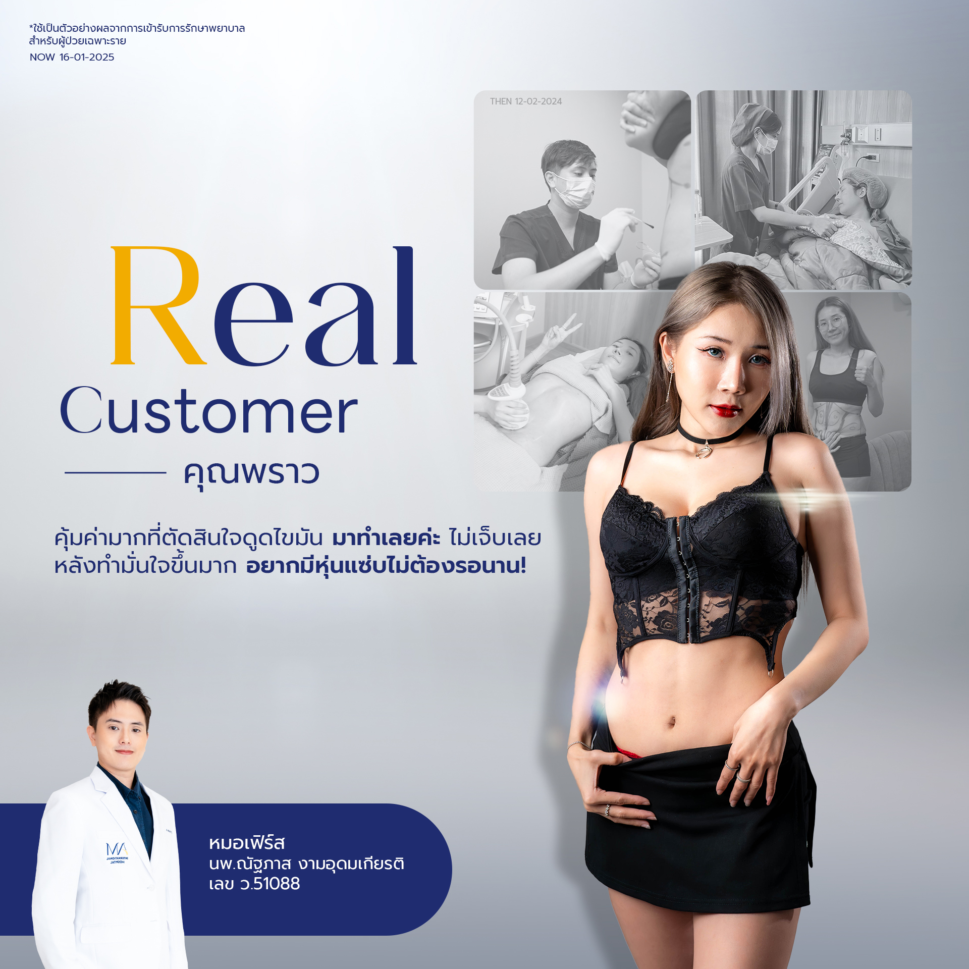 20250704-consi-Album-2025-07-02-AM-Testi-usp-13