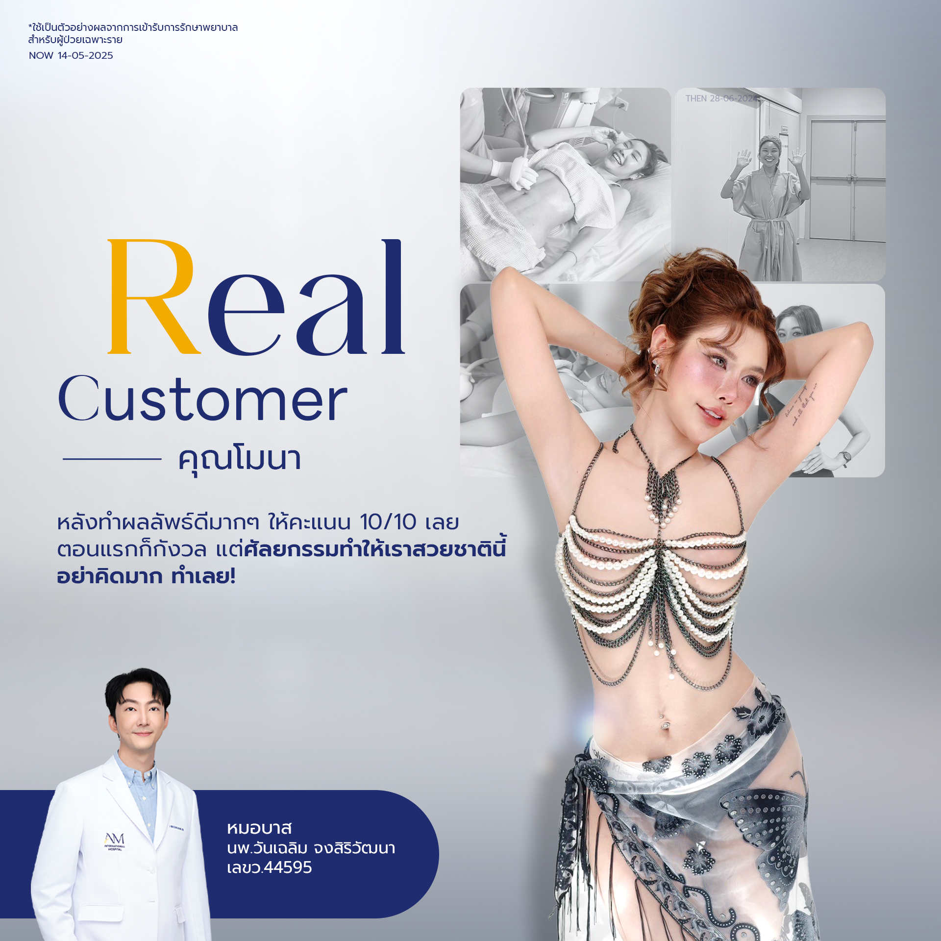 20250704-consi-Album-2025-07-02-AM-Testi-usp-7