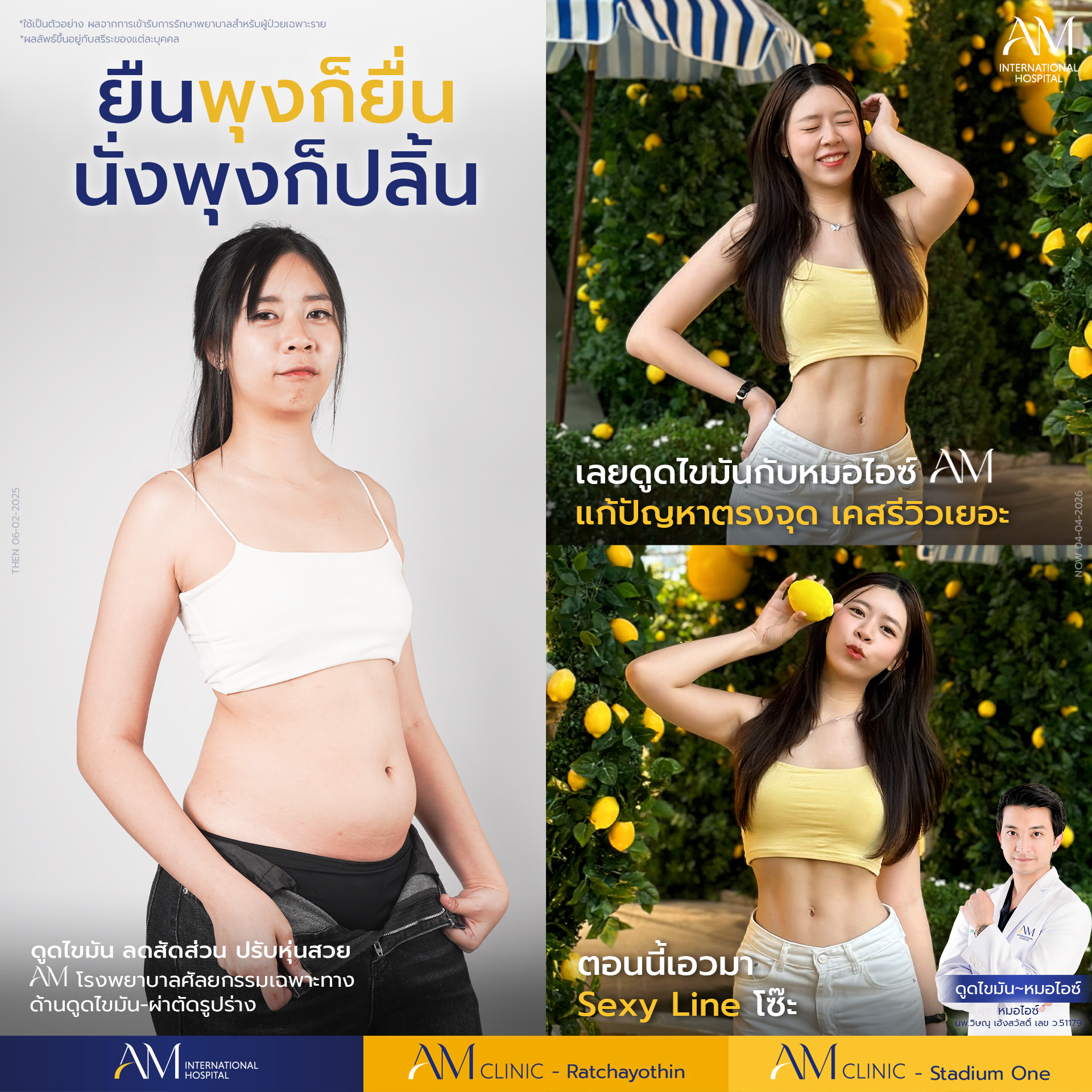 20260423-Aware-Single-Transformation-Real Review-หมอไอซ์-9630