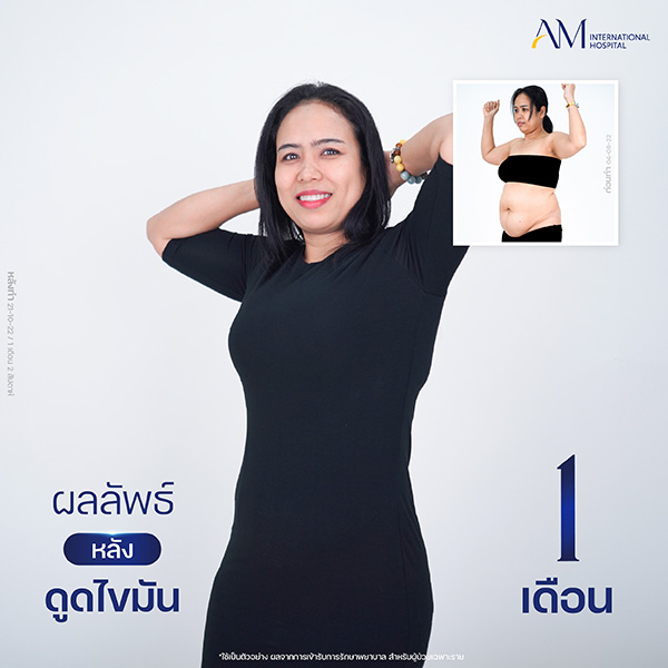 20260604-Website-awareness-Single-Webplussize-คุณแอน
