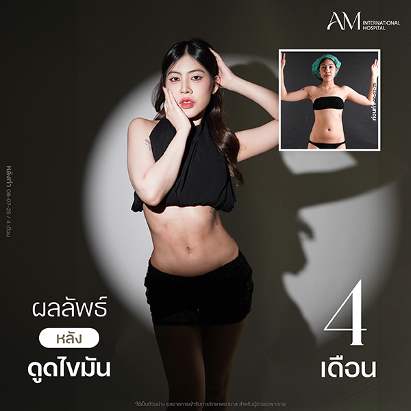 20260604-Website-awareness-Single-Webร่อง11-11750 คุ