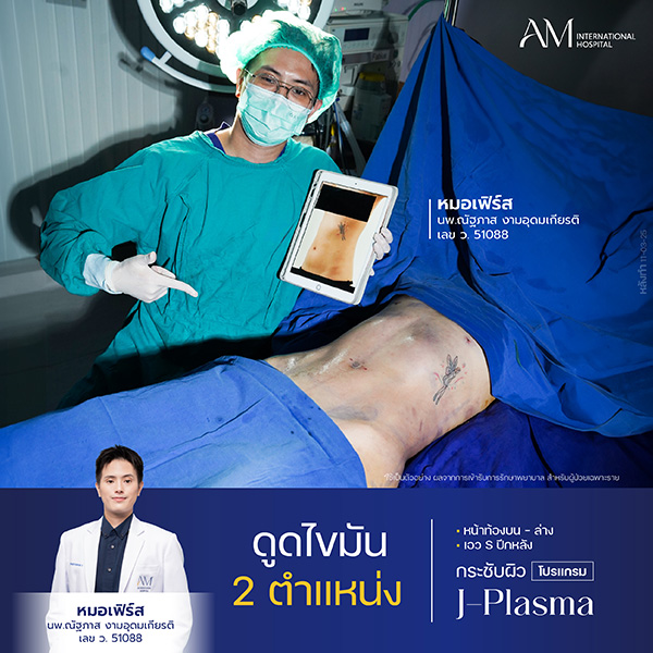 20260604-Website-awareness-Single-Webร่อง11OR-11750 ค