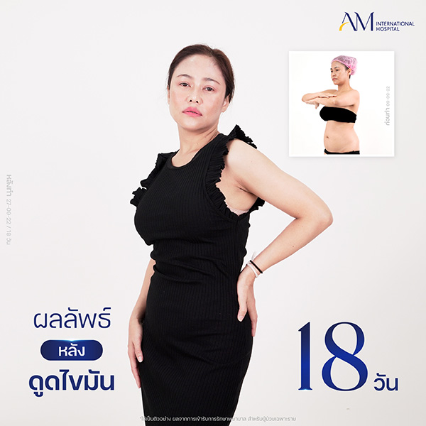 20260605-Website-awareness-Single-Webmommy-7703 คุณนั