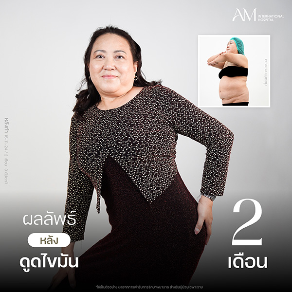 20260608-Website-awareness-Single-Webplussize-13772 คุณท
