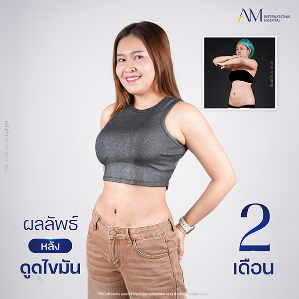 20260608-Website-awareness-Single-Webร่อง11-26-000168