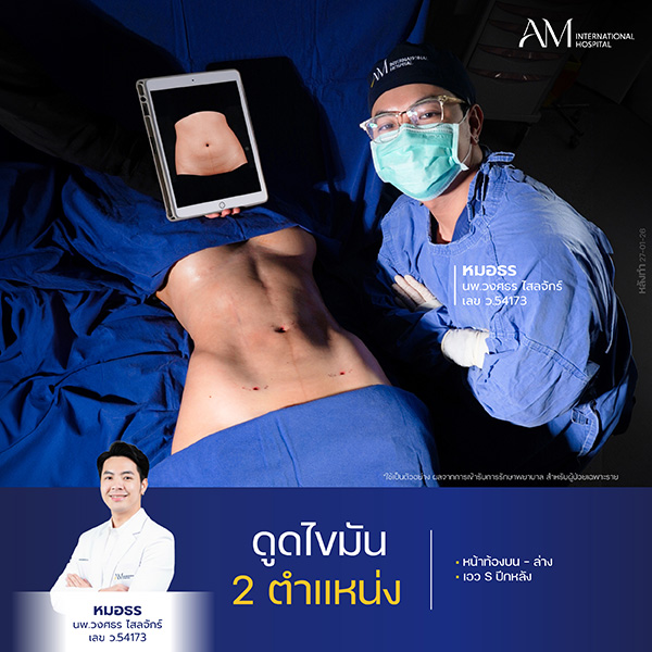 20260608-Website-awareness-Single-Webร่อง11OR-26-000168