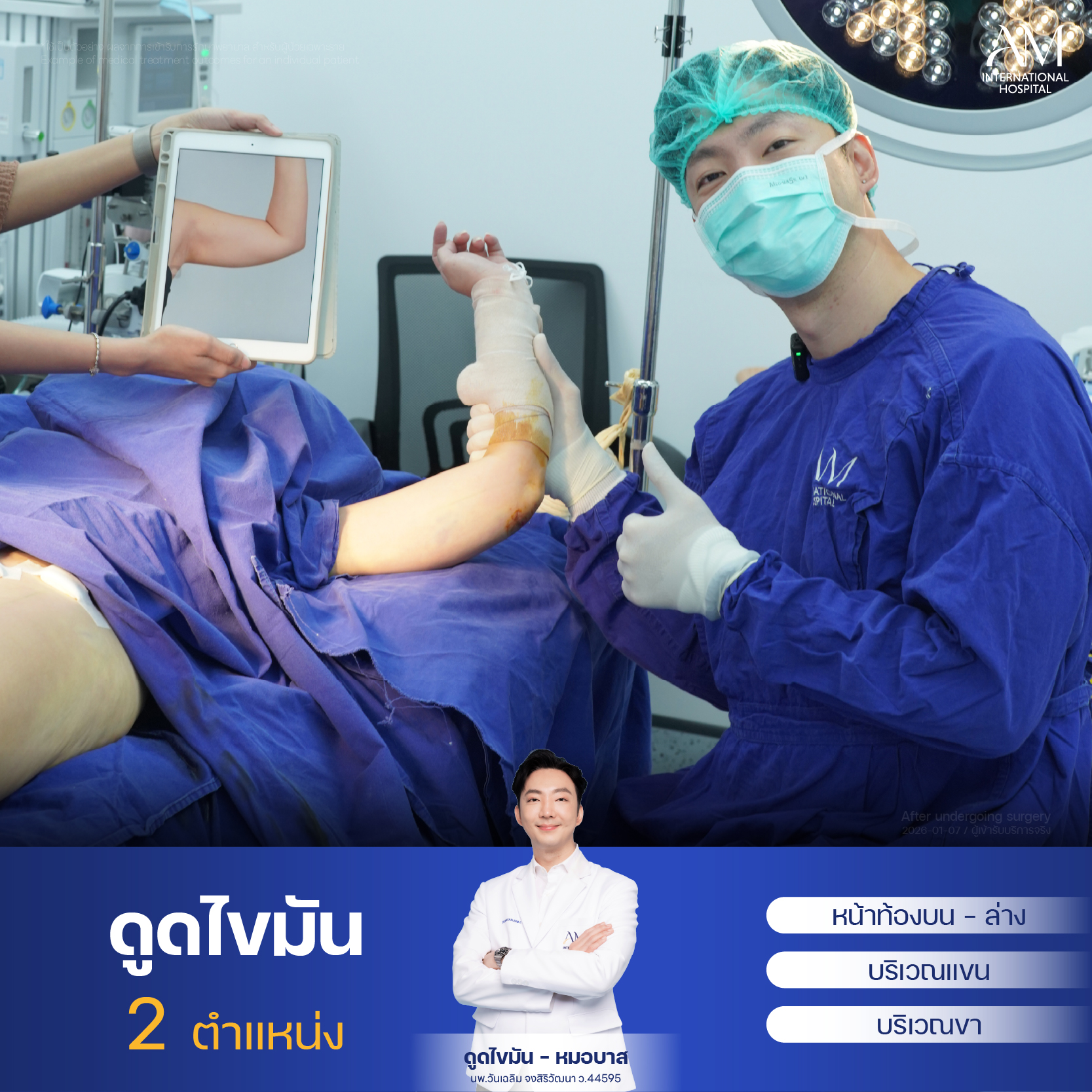 Webmommy-หลังทำOR-คุณแอน 9404