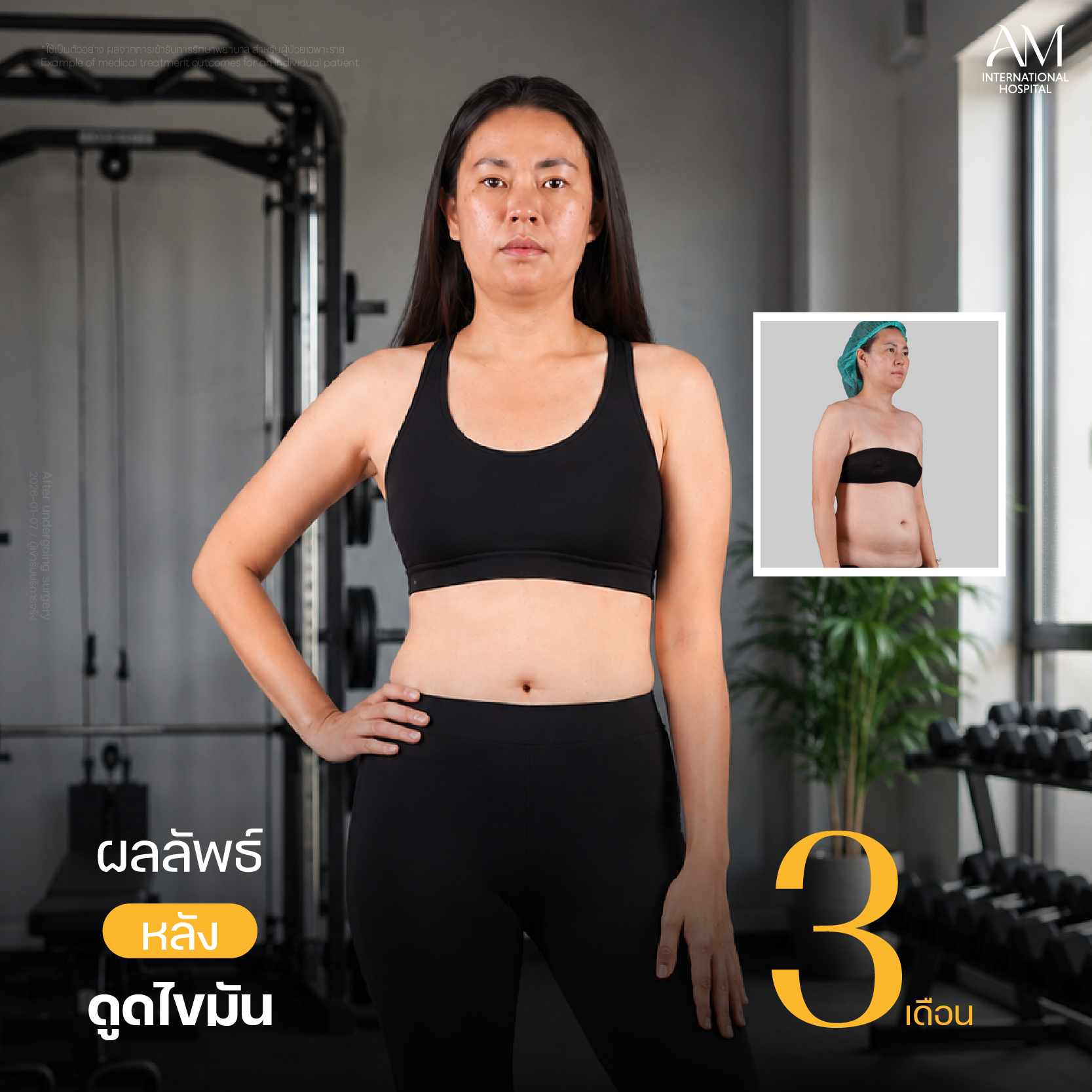Webplussize-คุณลูกตาล 25-001278