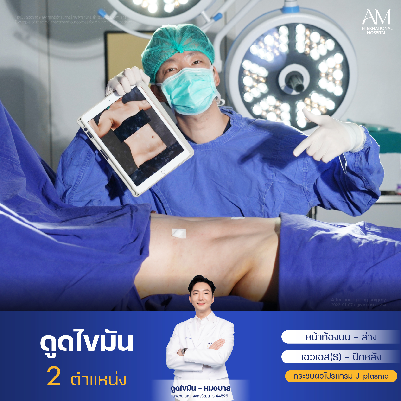 Webplussize-หลังทำOR-คุณลูกตาล 25-001278
