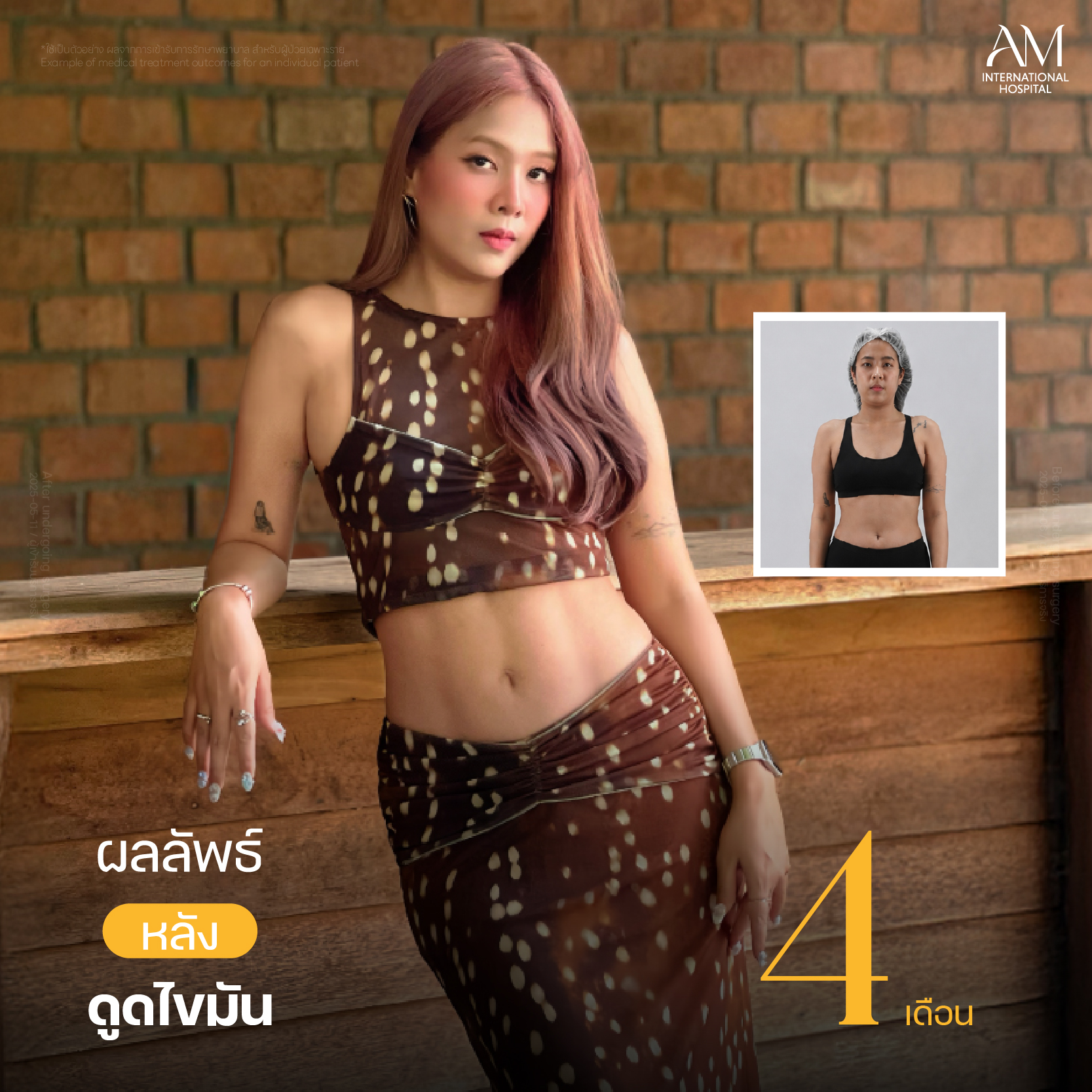 Webร่อง11-ลูกปลา 9644