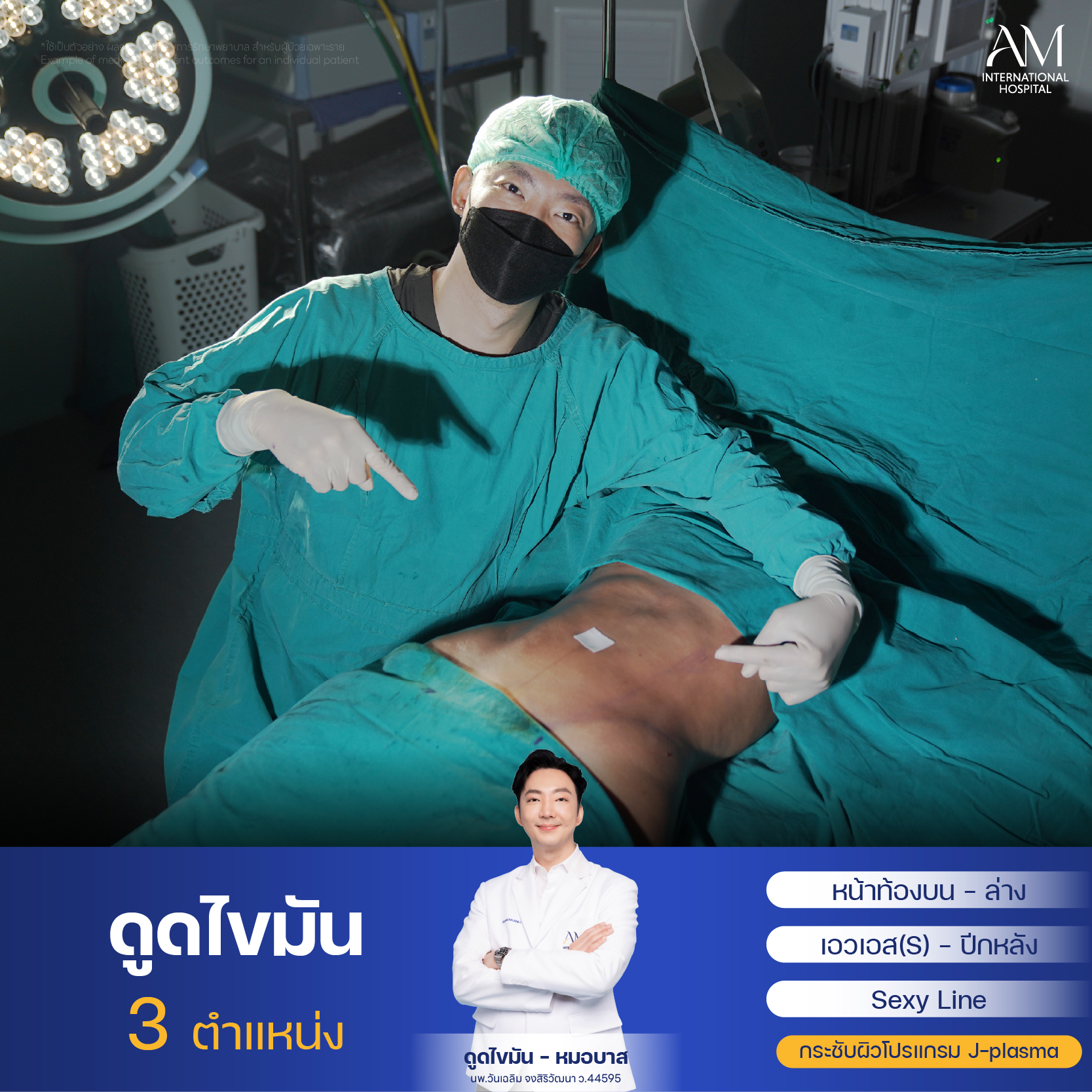 Webร่อง11OR-ลูกปลา 9644