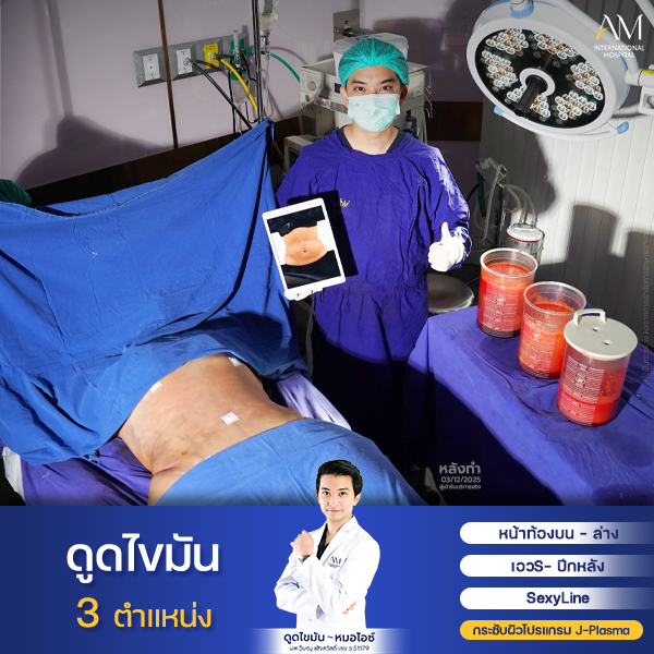 คุณธัญญ่า +size หมอไอซ์2