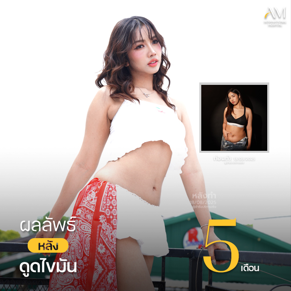 คุณบีม + size หมอไปร์ท1