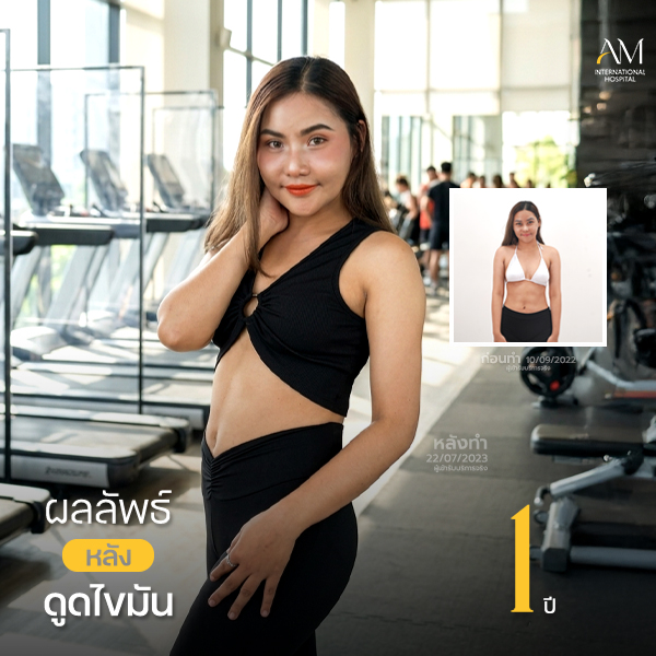 คุณป๊อปอาย Mommy หมอไปร์ท1