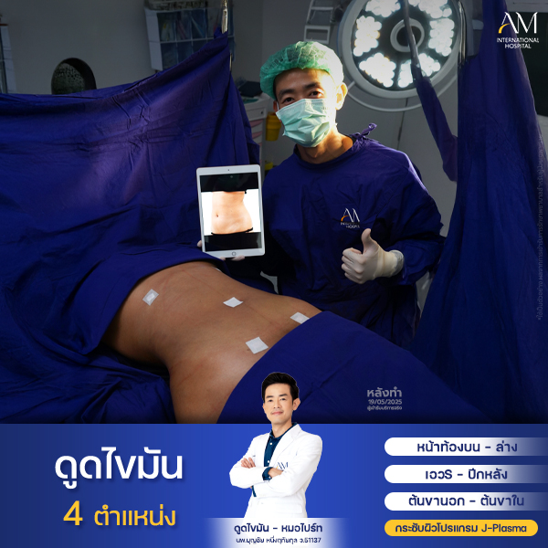 งานคุณบีม +size หมอไปร์ท2