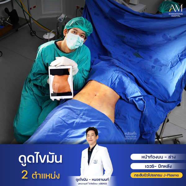 งานคุณเจี๊ยบ หมอชานนท์2