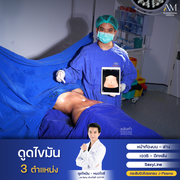 งานคุณเจ้าเอย Sexyline หมอไอซ์2