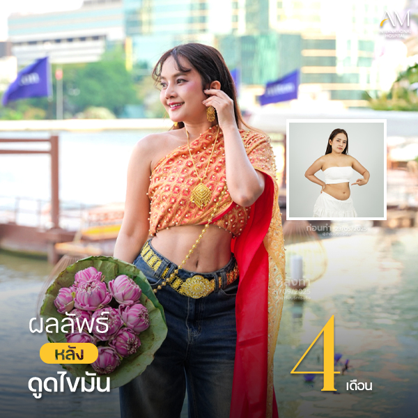 งานคุณเปี๊ยก หมอชานนท์