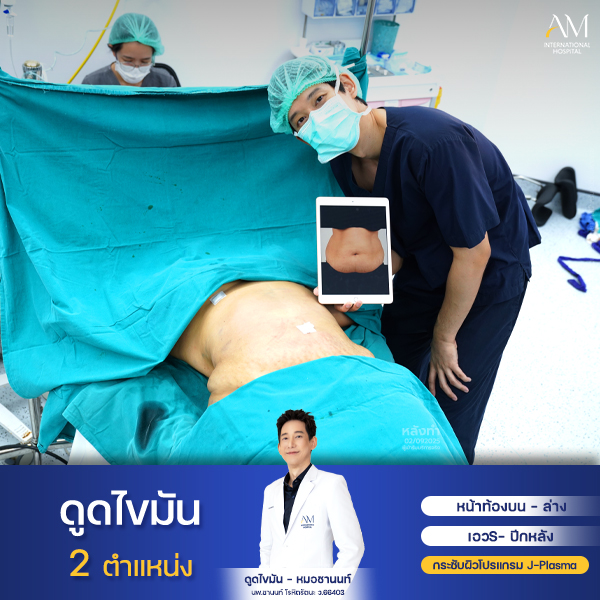งานคุณใหม่ หมอชานนท์2