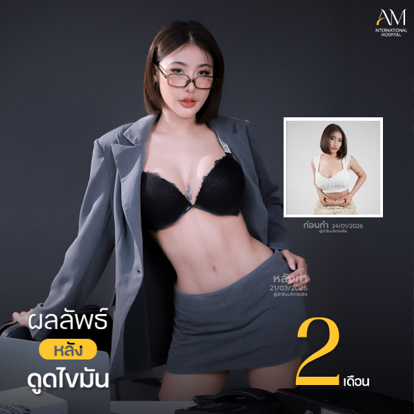 เจ้าเอย Sexyline หมอไอซ์2