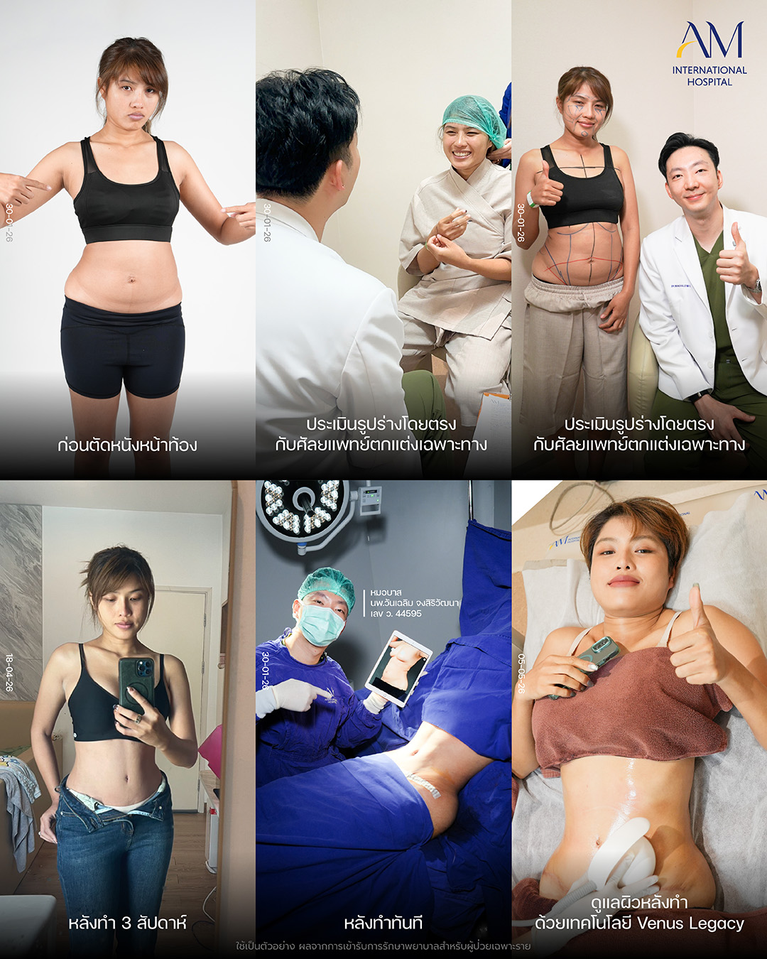 2026-06-30-BAReal-คุณแอน-26-000186